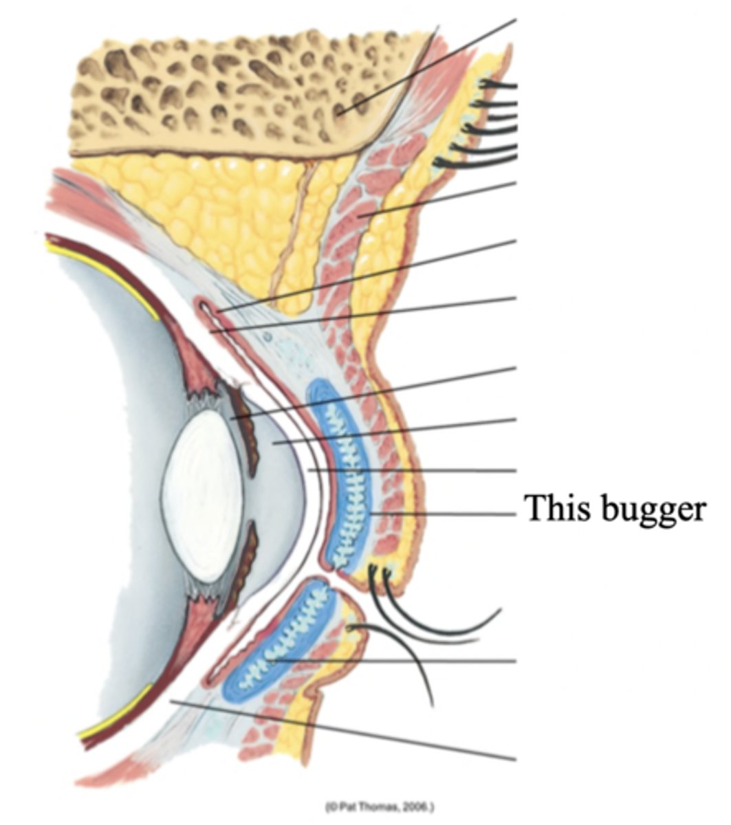 <p>Connective tissue within the upper eyelids that gives it shape</p>