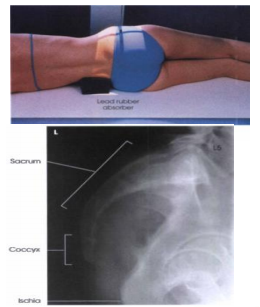 <p><span><strong>PP: </strong>Lateral recumbent; interiliac plane <strong>┴ </strong>to IR; pelvis &amp; shoulder in true lateral position</span></p><p><span><strong>RP</strong>: 3.5 in. posterior to ASIS</span></p><p><span><strong>CR: ┴</strong></span></p><p><span><strong>SS: </strong>Sacrum</span></p>