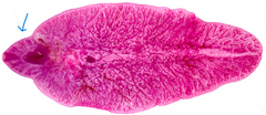 <p>Anterior projecting cone</p>