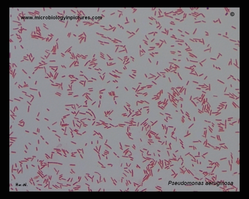 <p>What am i- gram stain, shape, arrangement</p>