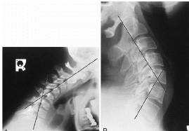 <p>Q what is the name of this measurement? and what is the average + range?</p>