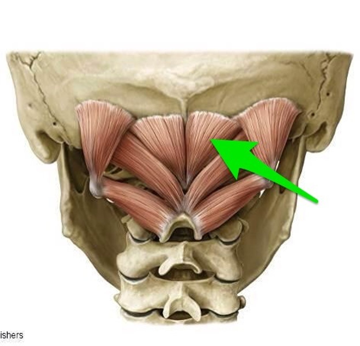 <p>Rectus Capitis Posterior Minor</p><p>origin</p><p>insertion</p>
