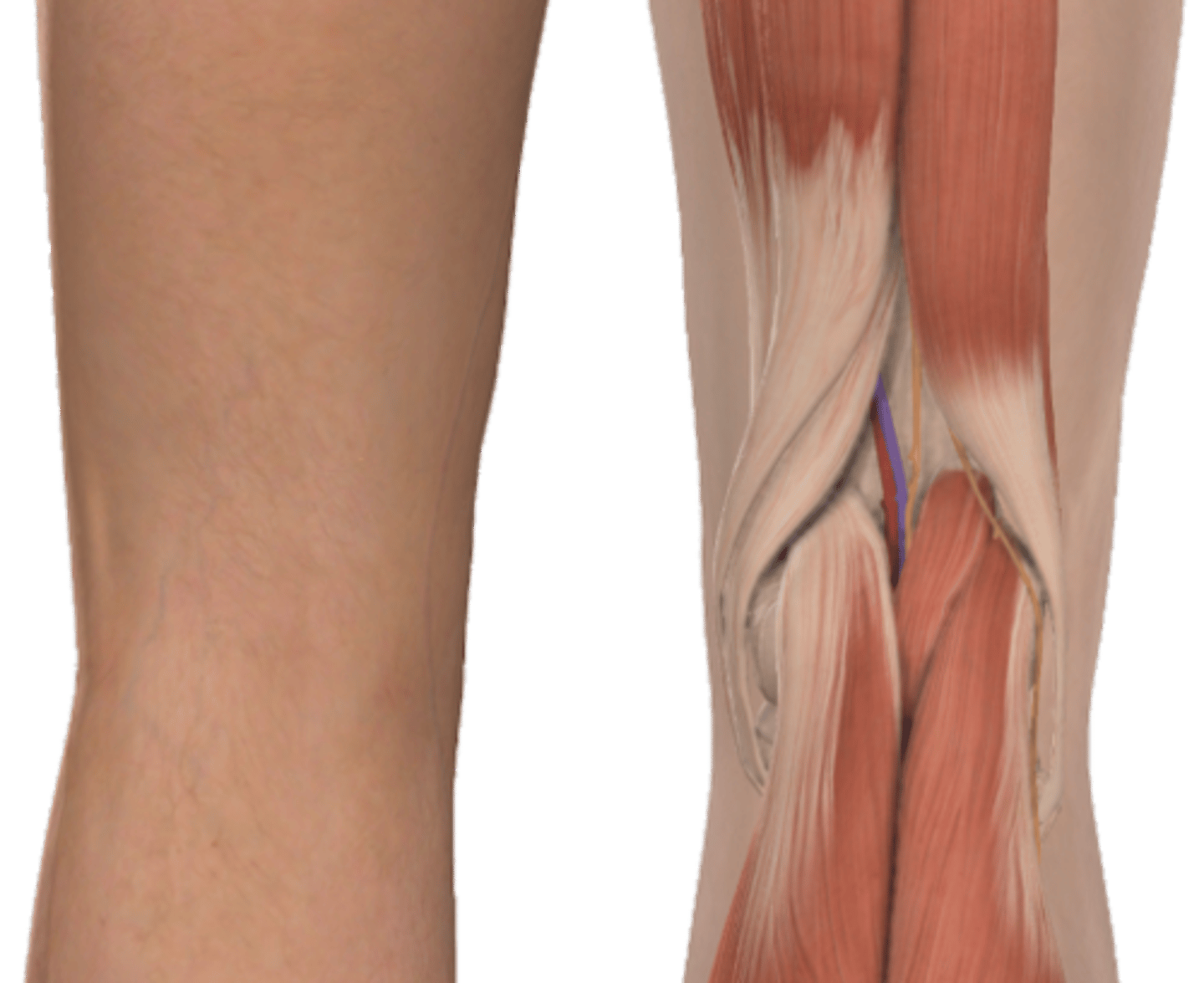 <p>A: Biceps femoris</p>