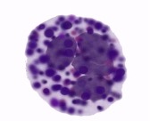 <ul><li><p>Contains dense basophilic granules</p><ul><li><p>Basophilic/ basic dyes stain granules&nbsp;→ stained blue</p></li></ul></li><li><p class="MsoListParagraphCxSpLast">Specific features in allergy response and offer protection from worms etc</p><ul><li><p class="MsoListParagraphCxSpLast">Involved in killing large organisms</p></li></ul></li><li><p class="MsoListParagraphCxSpLast">Resemble tissue mast cells - have a similar origin </p></li></ul><p></p>