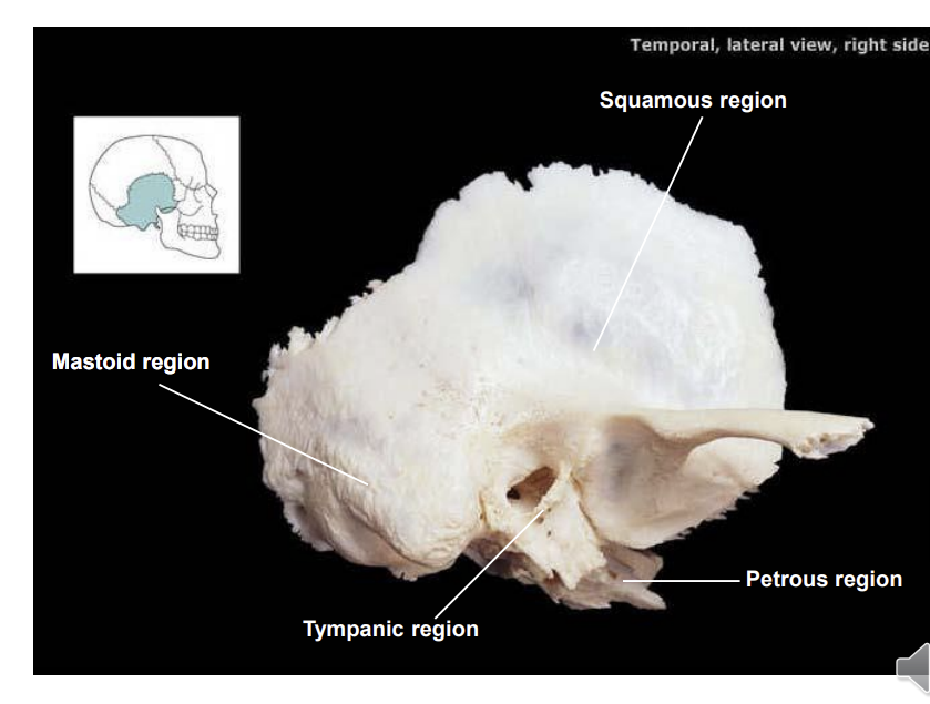 <p>squamous region - lateral aspect</p><p>petrous region on the base of the skull</p>