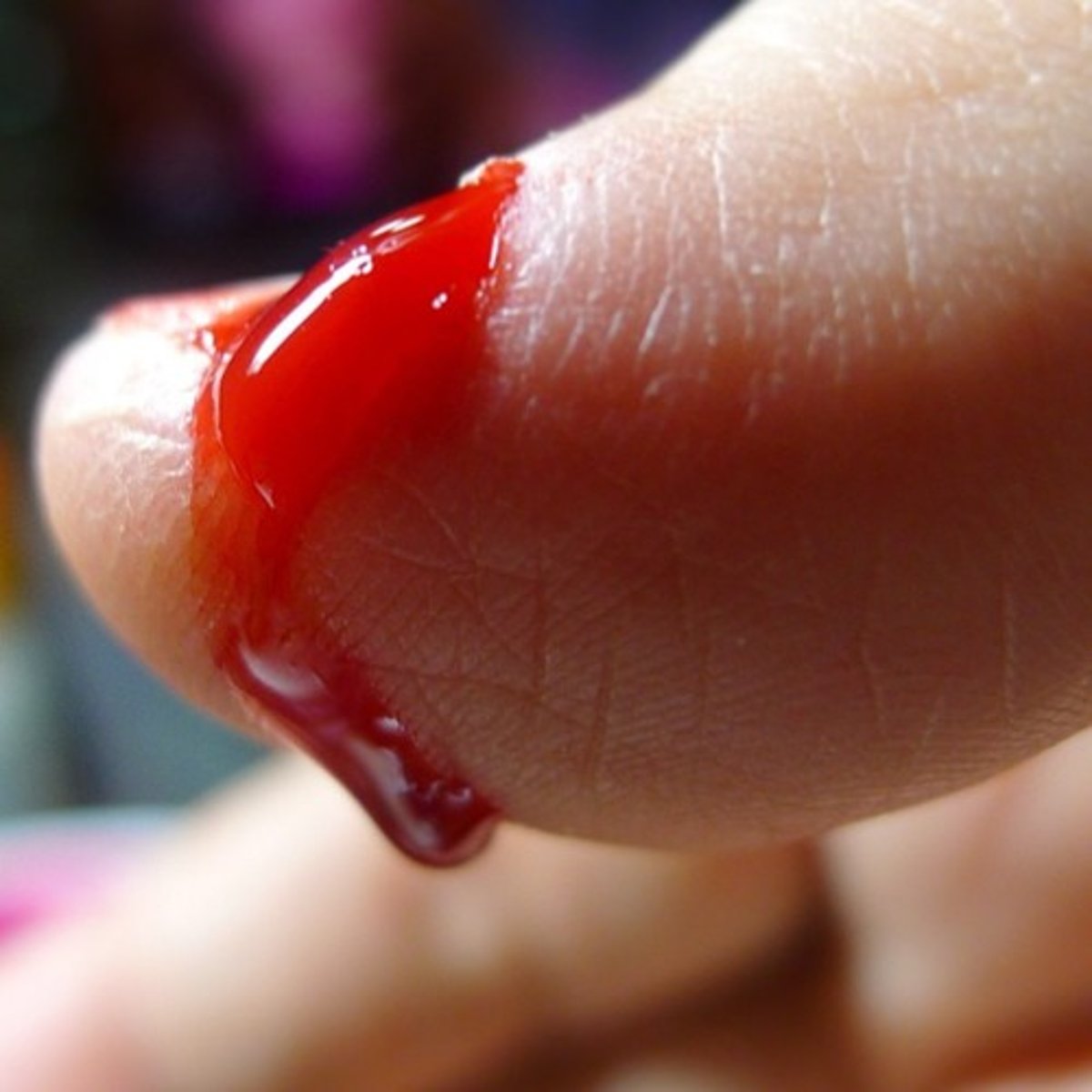 <p>clot</p>