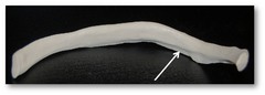 groove on the inferior side of the rib shaft