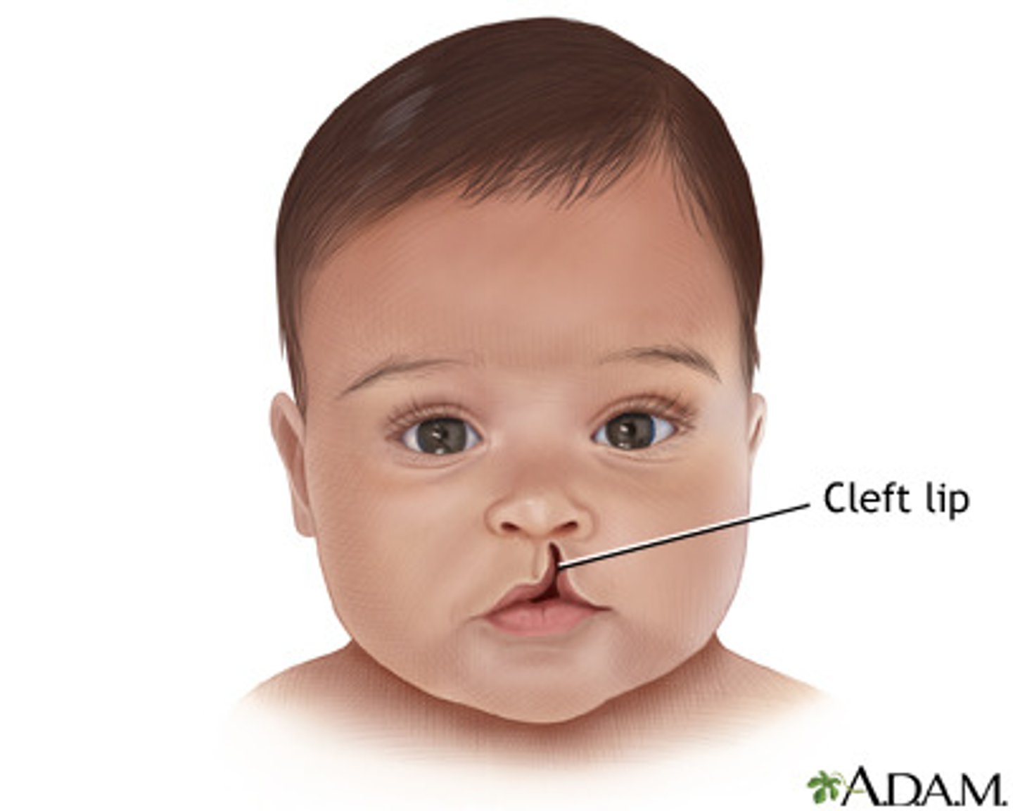 <p>medial nasal process</p><p>maxillary process</p>