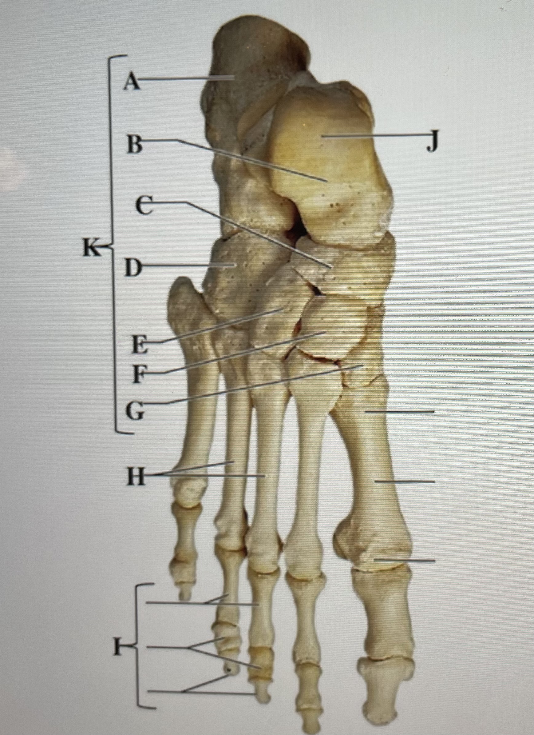 In the figure above,  *is teh calcaneus and* _ are the phalanges 