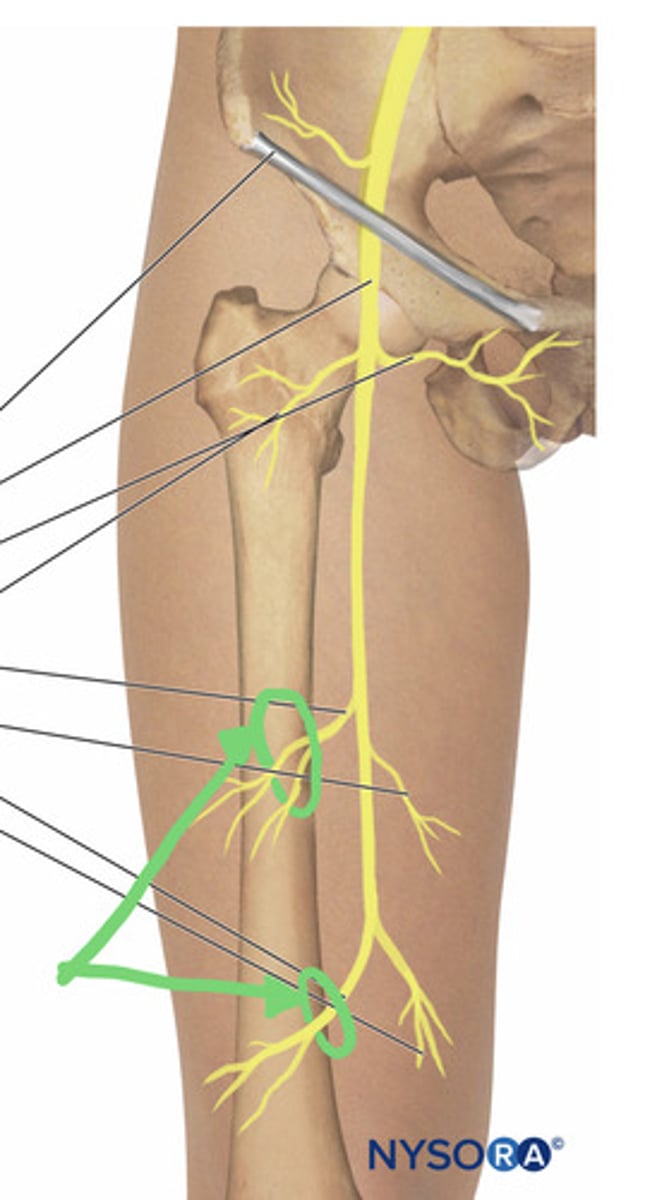 <p>Iliacus, pectineus, sartorius, quadriceps femoris</p>