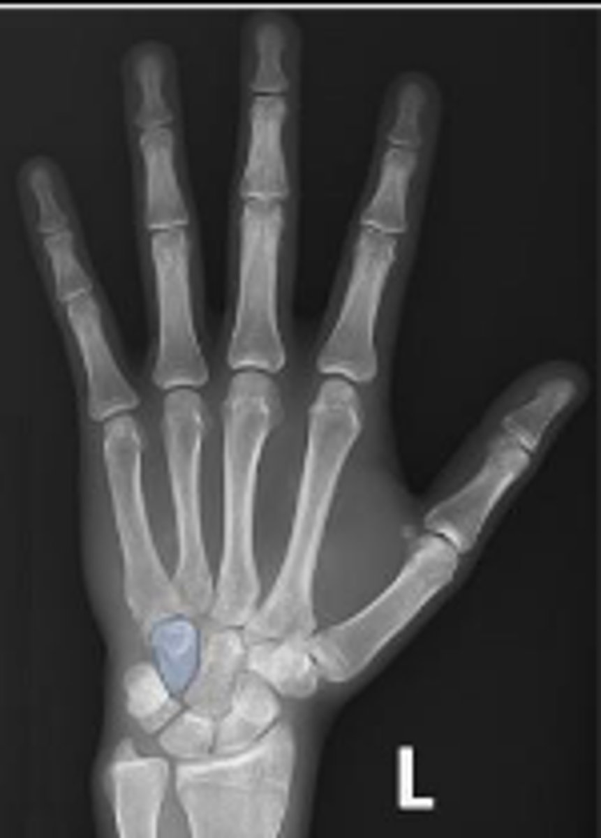 <p>What is outlined?</p>