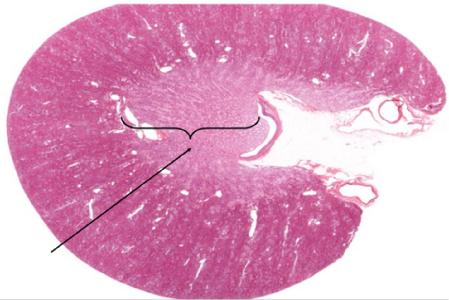 <p>Identify the structure on the kidney</p>