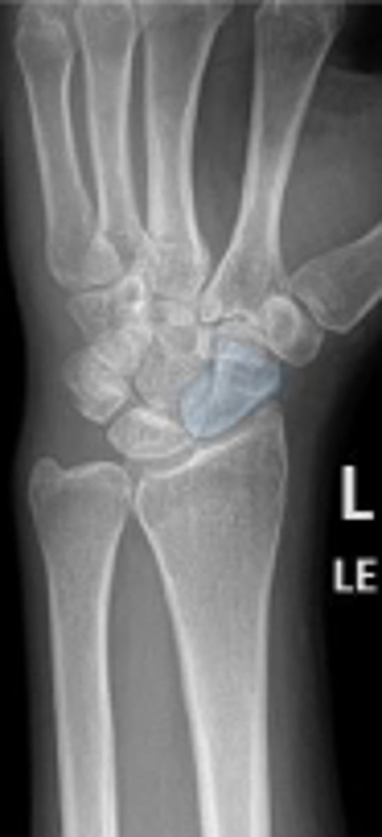 <p>What is outlined?</p>