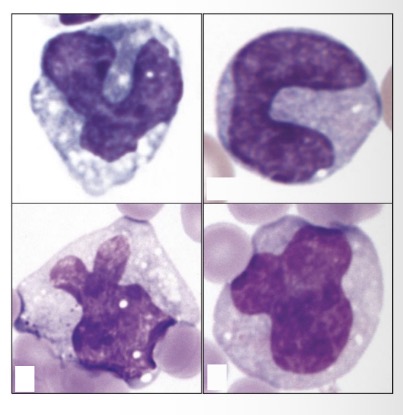 <p>Monocyte cytoplasm appearance </p>