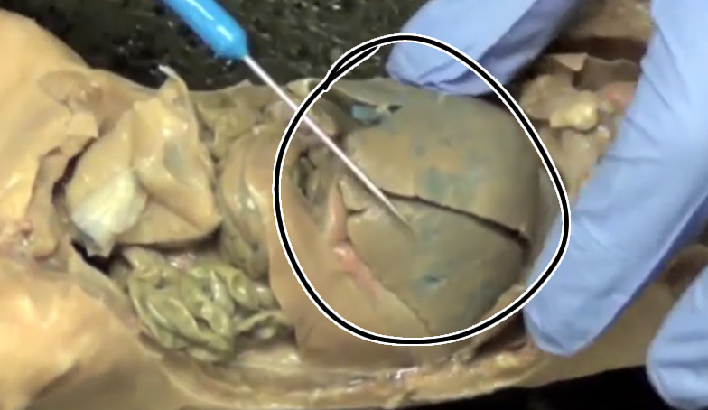 <p>What is this? Purpose?</p>