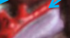 <p>A branch of the celiac artery that supplies oxygenated blood to the liver.</p>