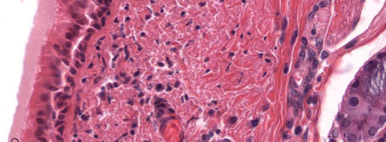 <p>What surface mechanism is this?</p>