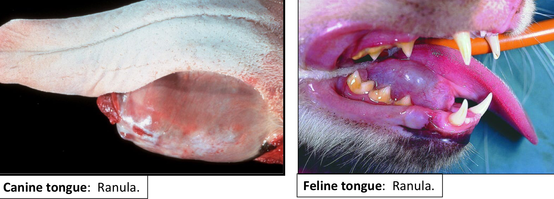 <ul><li><p>True Salivary Cysts</p><ul><li><p>Distention/dilation of a salivary gland </p></li></ul></li><li><p>Ranula</p><ul><li><p>True Salivary cysts on the floor of the mouth or along the side of the tongue</p></li></ul></li></ul><p></p>