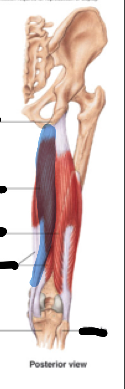 <p>Name, origin, insertion, innervation</p>