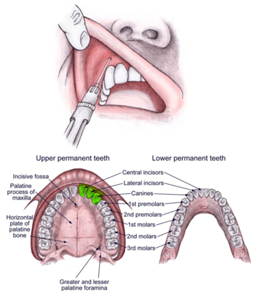 <p>Max anterior teeth and facial gingival tissue</p>