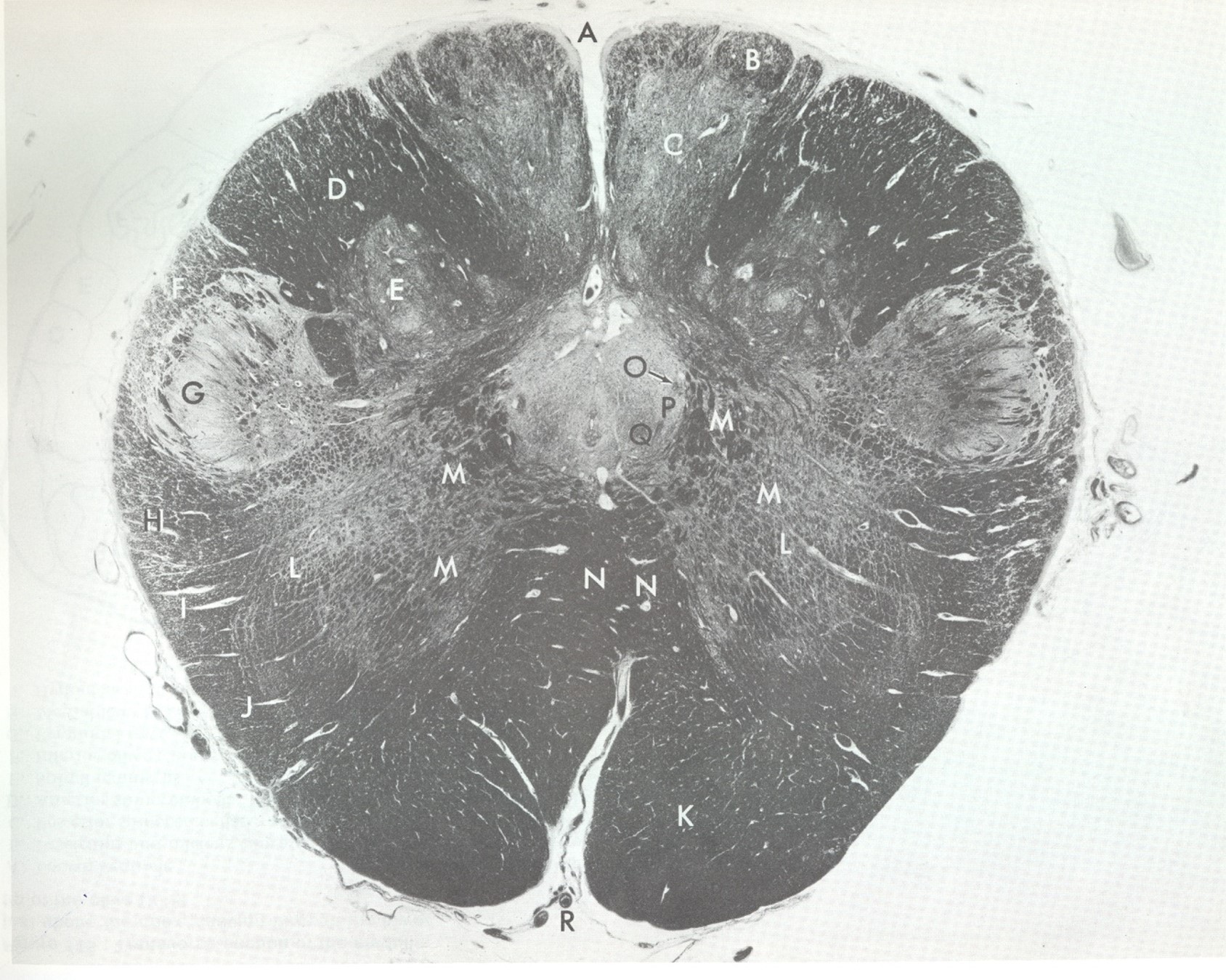 <p>k</p>