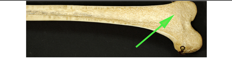 <p>What type of bone is marked by the green arrow?</p>