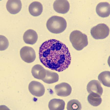 <p>What is this neutrophil showing?</p>