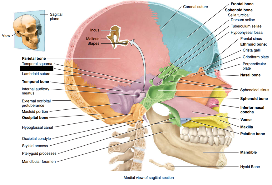 <p>State and identify what part of the cranial bone is being pointed out and censored. (hint: Suture)</p>