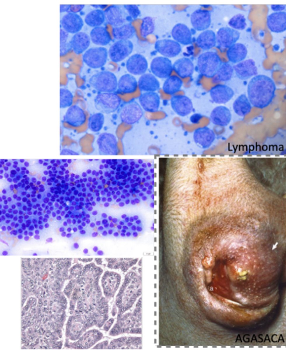 <p>What kind of tumor is this? (broad category)</p>