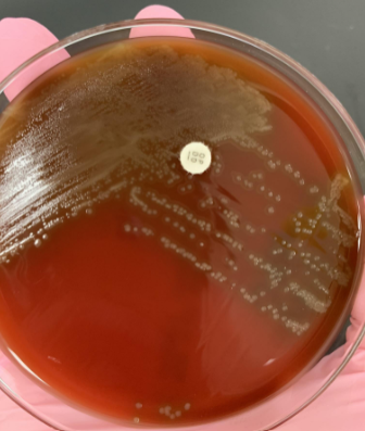 <p>lets say you subbed alpha hemolysis to a new plate and put an optochin disk on the plate, and did bile solubility and it was (-) , what does this result tell you</p>