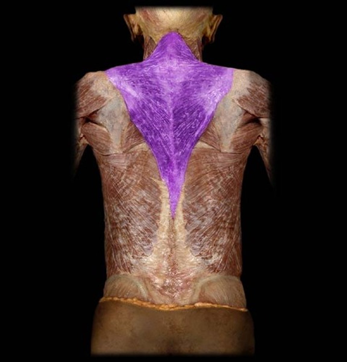 <p>upper back muscle (connects to sternocleidomastoid)</p>