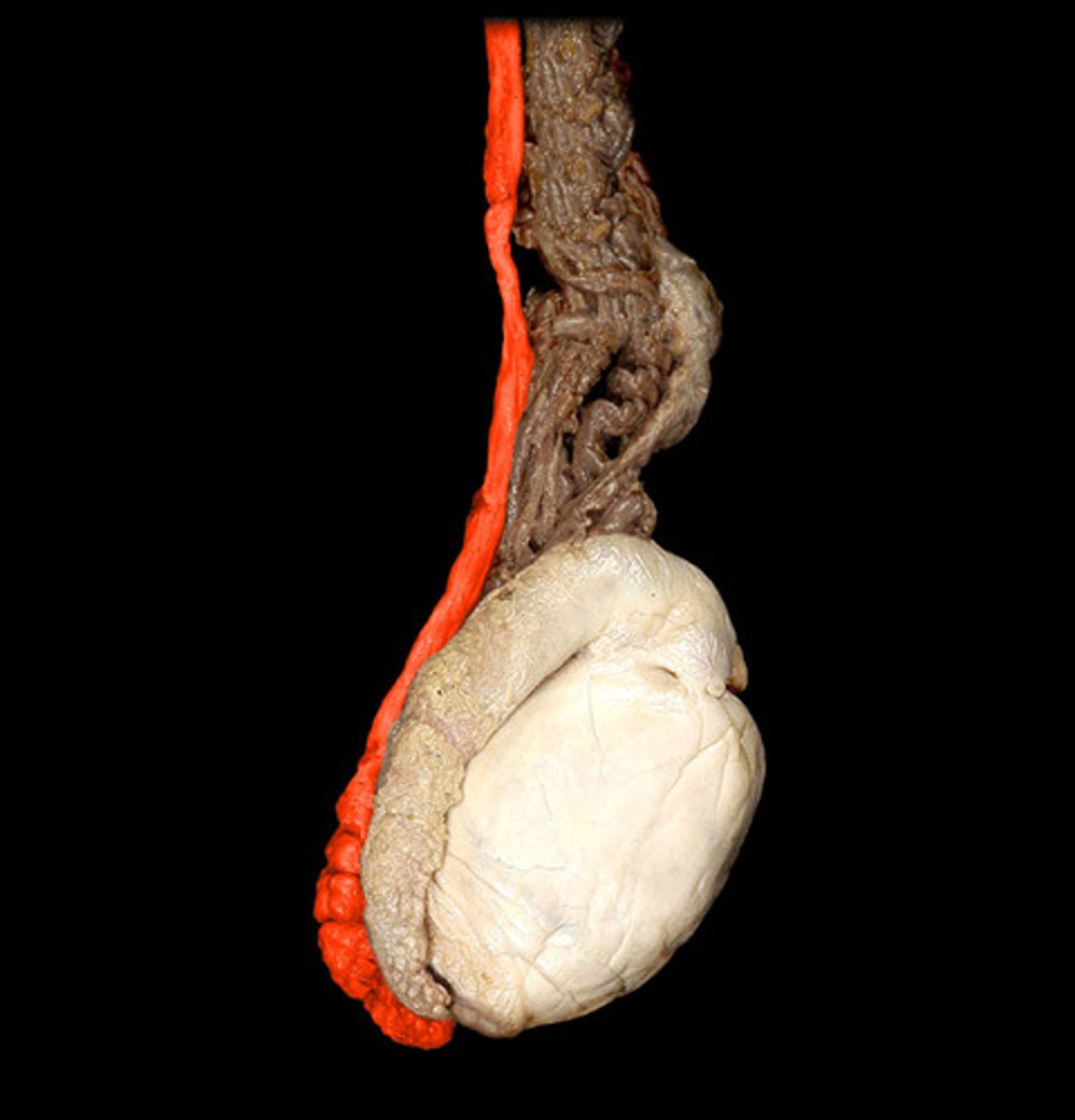 <p>"ductus deferens"</p><p>-transports mature sperm to the urethra during ejaculation</p><p>-connects to tail of the epididymus</p>