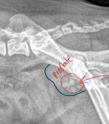 <ul><li><p>not seen if castrated</p></li><li><p><strong>Prostatomegaly: big</strong></p><ul><li><p><strong>BPH: benign </strong></p><ul><li><p>Intact male dogs</p></li><li><p>castration fixes</p></li></ul></li><li><p><strong>Prostatitis</strong></p><ul><li><p>Staph or strep</p></li><li><p>dogs <strong>VERY sick</strong></p></li></ul></li><li><p><strong>Prostatic neoplasia</strong></p><ul><li><p><u>Adenocarcinoma</u>, transitional cell carcinoma</p></li><li><p>mineralization of prostate = cancer</p></li></ul></li><li><p><strong>Paraprostatic cysts (next to)</strong></p><ul><li><p><u>3 bladders on lateral view</u></p><ul><li><p>1) bladder, 2) prostate, 3) cyst</p></li><li><p>fluid filled: benign </p></li></ul></li></ul></li></ul></li></ul><p></p>