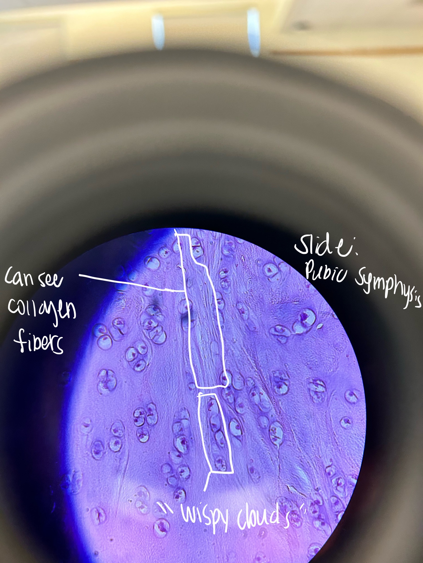 <p>Where would you find Fibrocartilage Cartilage and what does it do?</p>