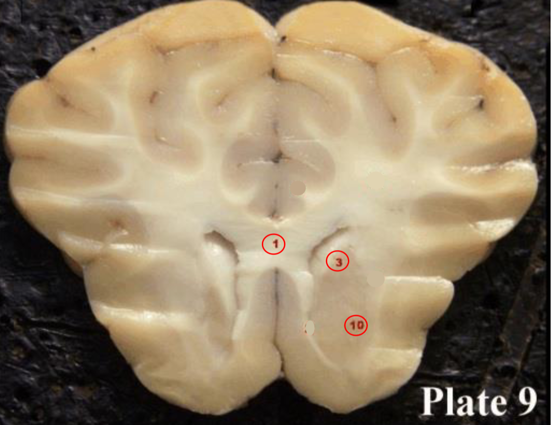 <p><span>caudate nucleus</span></p>