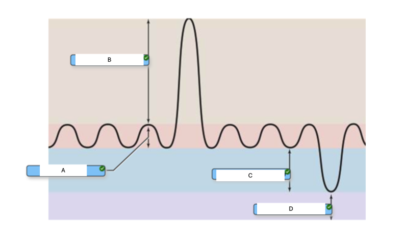 <p>In the graph below of a respiratory cycle, which letter corresponds to the residual volume? </p><p></p>