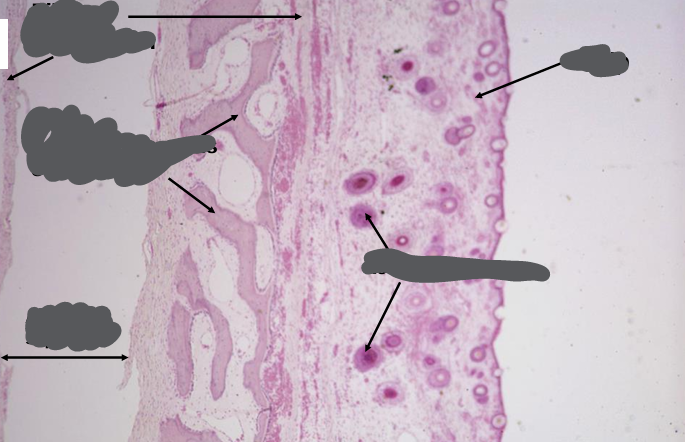 <p>intramembranous bone formation</p>