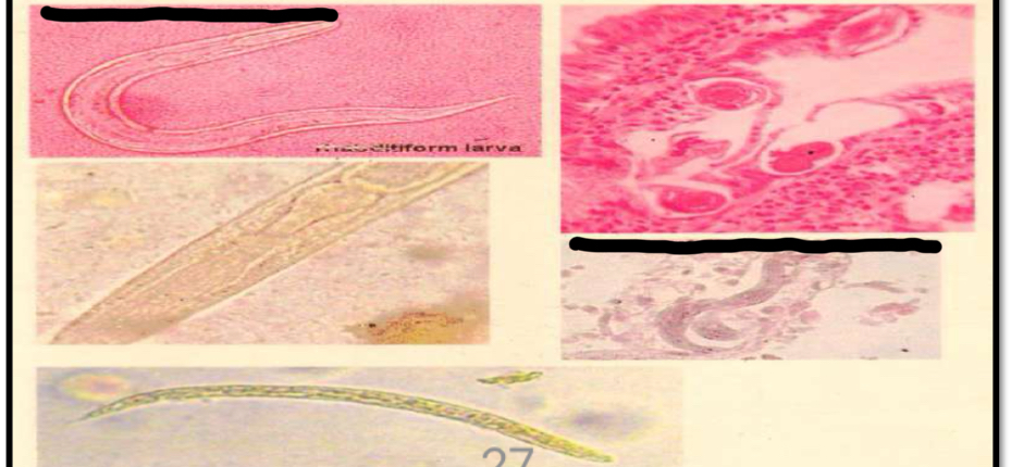 <p>Parasite under microscope?</p>
