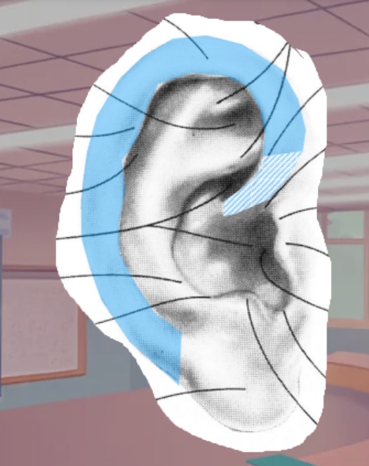 <p>What is this part of the pinnacle called</p>