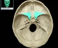 <p>One of two side wings extending from the body of the sphenoid bone</p>