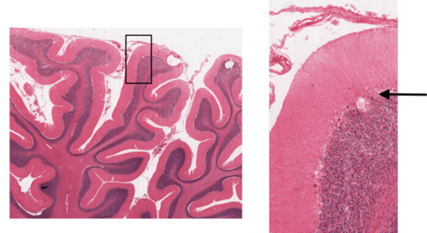 <p>Identify the layer of the cerebellum</p>