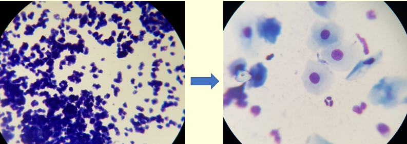 <p>Vaginal Cyto - What is this?</p><p>Defined as?</p>
