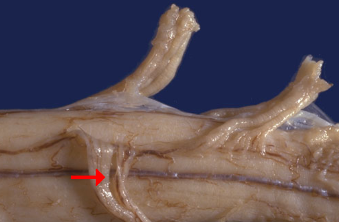 <p>Label this region of the spinal cord</p>