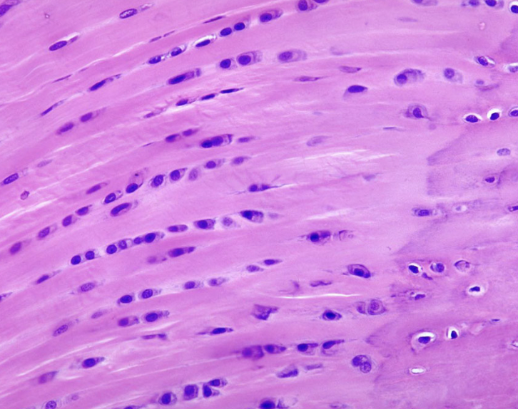 <p><strong>-numerous collagen fibers in rows of 4 or 5</strong></p><p><strong>-function</strong> → <strong>protects from wear & tear at weight-bearing or stressed joints</strong></p>