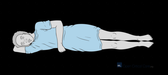 <p>Left/right lateral recumbent position</p>
