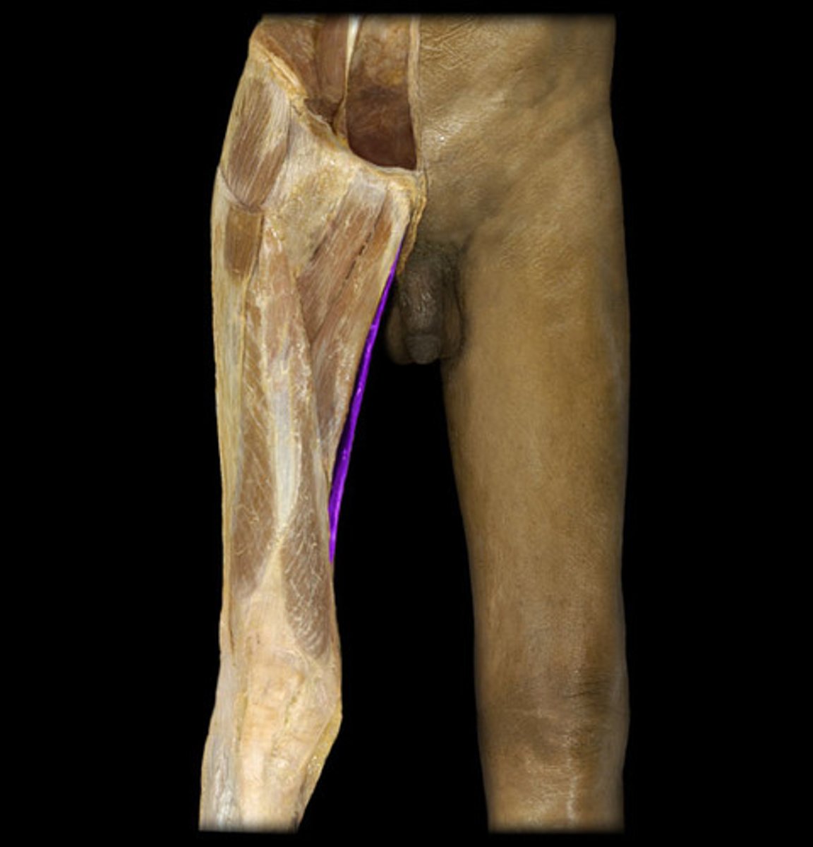 <p>body and inferior ramus of pubis</p>