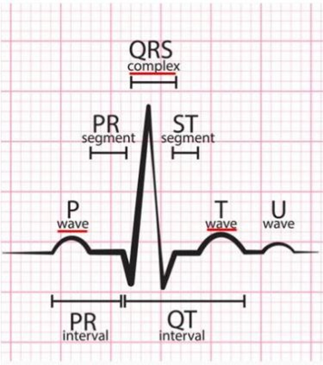 <p>What does this figure represent?</p><p>Name the event that happens during the P-wave?</p><p>Name the event that happens during the QRS complex?</p>