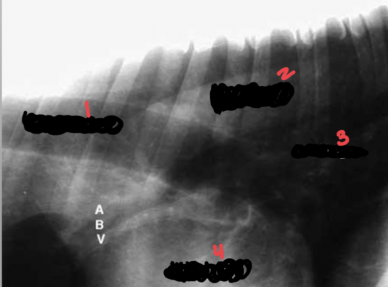 <p>identify lung aorta trachea heart</p>