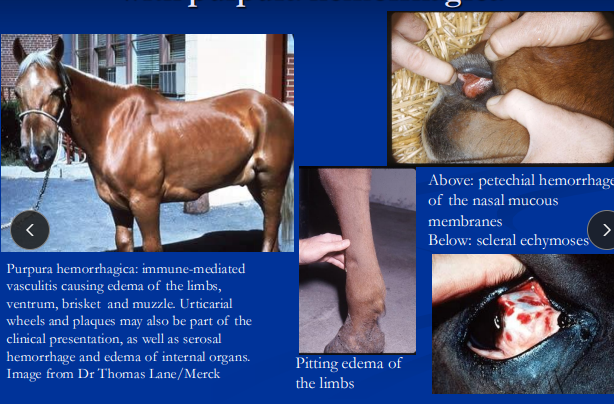 <p><span>Purpura Hemorrhagica</span></p>
