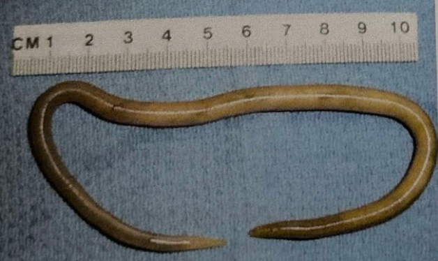 <p>Following the dehelminthisation of domestic swine, the following nematodes have been found in faeces; write the species name.</p>